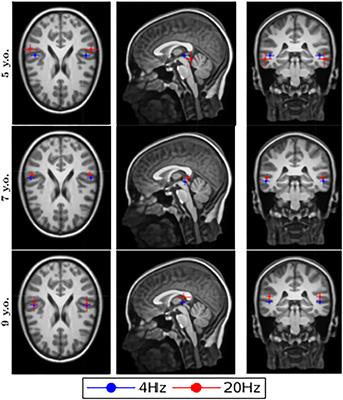 Development of Atypical Reading at Ages 5 to 9 Years and Processing of Speech Envelope Modulations in the Brain